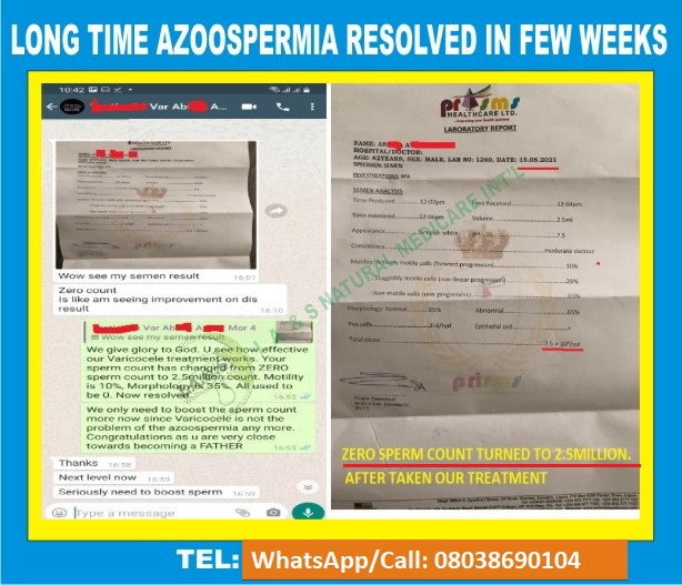 Azoo-4-LONG-TIME-AZOOSPERMIA-RESOLVED-IN-FEW-WEEKS (1)