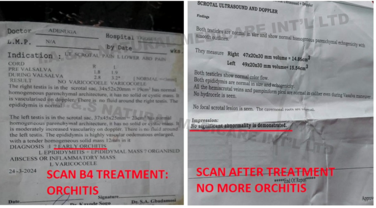 ORCHITIS-TEST-768x424