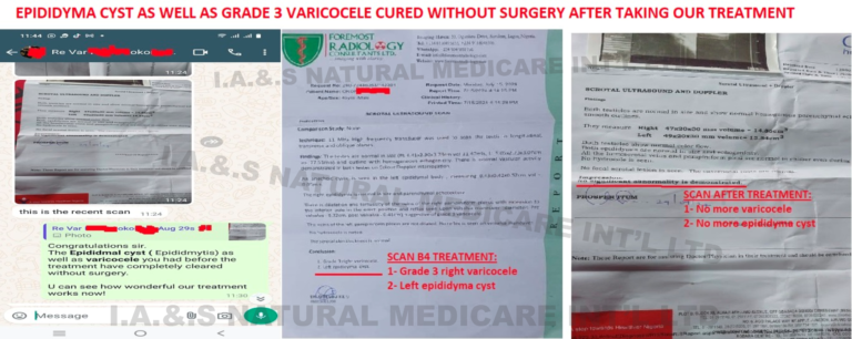 EPIDID-VARICOCELE-TEST-768x306