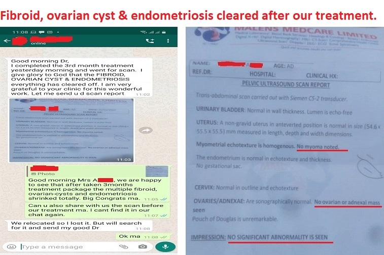 Fib-5.-3-in-1-Tretment-Fibroid-Ovarian-Cyst-Endometriosis-all-cleared-naturally-without-surgery-after-our-treatment